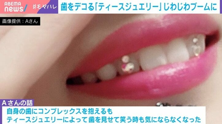 ティースジュエリー