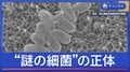 薬が効かない？　謎の細菌　正体は