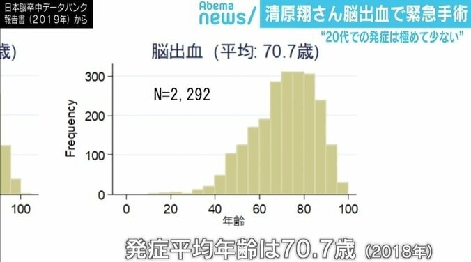 俳優・清原翔「脳出血」で緊急手術…発症極めて少ない20代でなぜ？ 症状を察知する“FAST” 2枚目