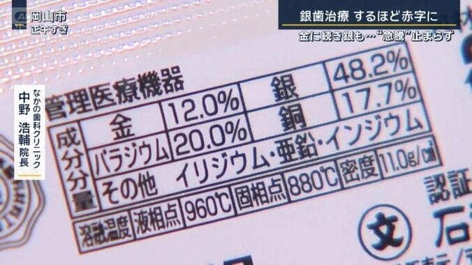 銀歯の成分