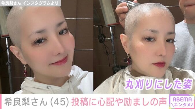 “GTO出演俳優”がん闘病中の希良梨さん（45）、副作用で歯が抜けたことや検査結果への不安つづる「助けてください」 4枚目
