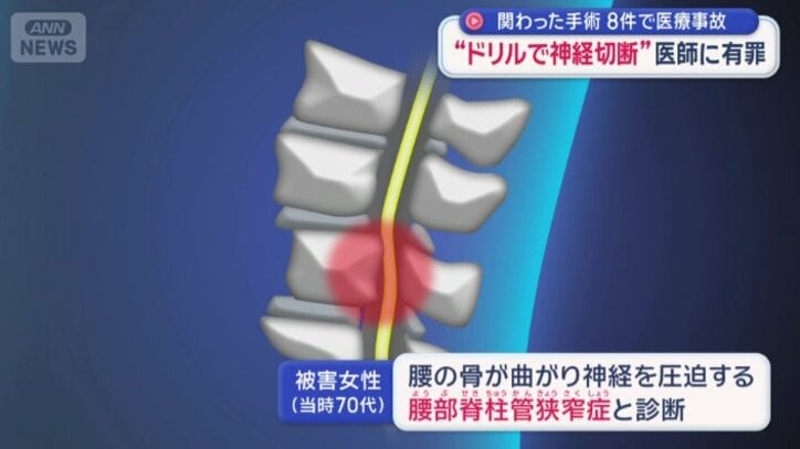 「早急に手術したほうがいい」と促された