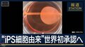 “仮免許”→“本免許”への道のりは？世界初『iPS細胞由来』条件付き承認へ