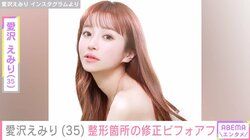 元歌舞伎町No.1キャバ嬢・愛沢えみり（35）、整形箇所の修正を報告＆ビフォアフ公開 「土台は思い切って課金する」