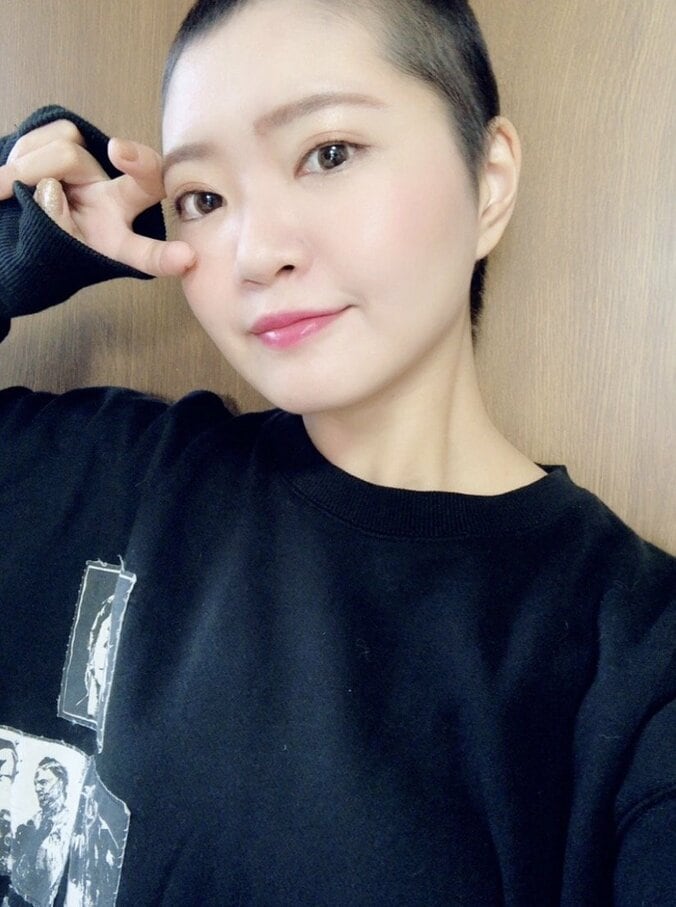 乳がん治療中の矢方美紀、髪が生えてきた地毛姿を公開「髪が生えただけで幸せ！」 1枚目