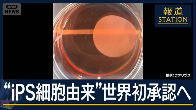 “仮免許”→“本免許”への道のりは？世界初『iPS細胞由来』条件付き承認へ 1枚目