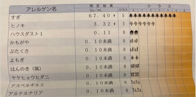 アレク、息子のアレルギー検査の結果を報告「目薬は中々やらせてもらえないよ笑」 1枚目