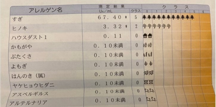 アレク、息子のアレルギー検査の結果を報告「目薬は中々やらせてもらえないよ笑」