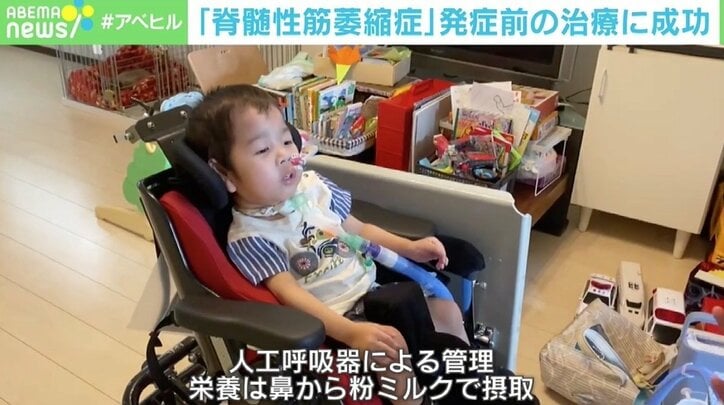 筋萎縮症