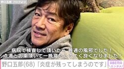 39.4度の高熱とのどの痛みを訴えた野口五郎（68）、現在の体調を報告「炎症が残ってしまうのですよネ」