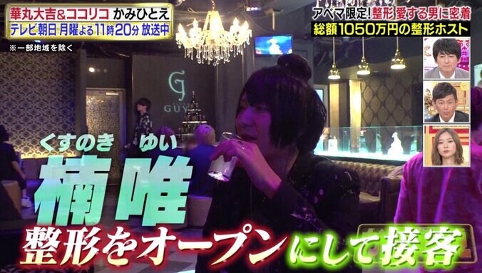 「しんどいくらい好き」美容整形に1050万円かけたホスト、常連客から愛される理由とは？ 2枚目