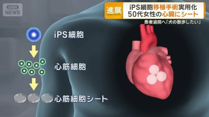 心臓の表面に貼り付け血管の再生促進、機能回復