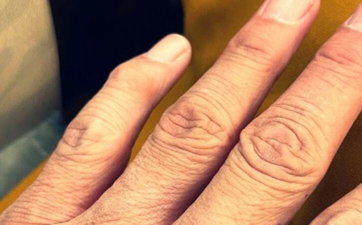  高橋克典、指の痺れが取れないことを告白「これってやばい？」 