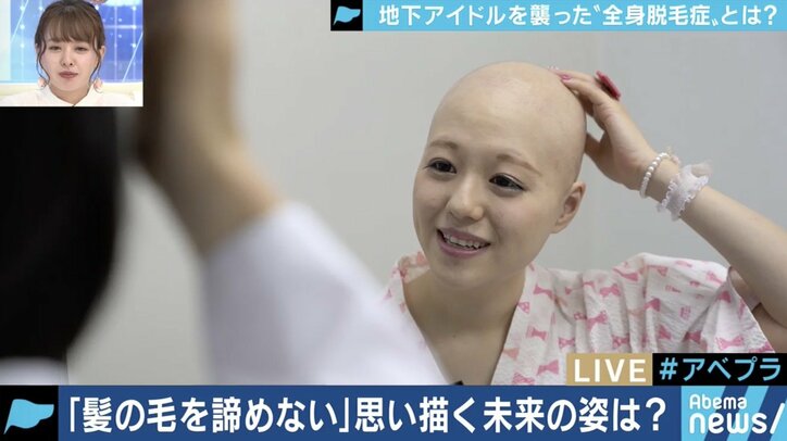 「頭が丸くても続けたい」…全身脱毛症アイドル、告白の裏にファンの後押しも
