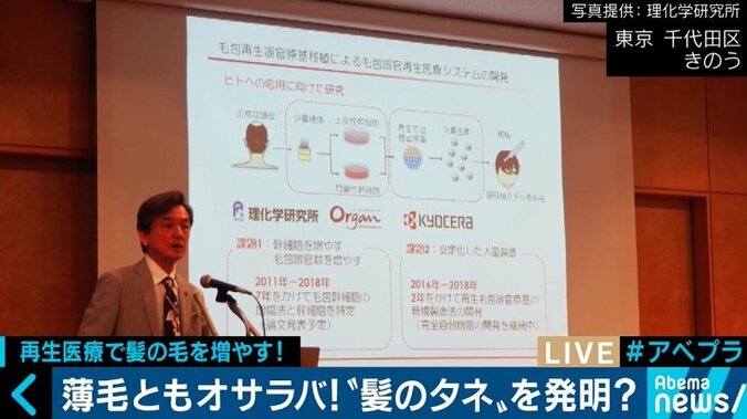 2020年には薄毛治療に革新？日本の再生医療技術がついに“髪のタネ”を発明 2枚目