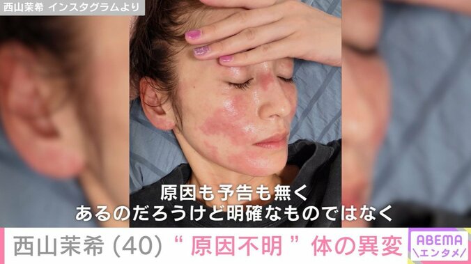 西山茉希