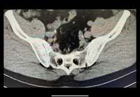 サンドウィッチマン富澤『また、来たか…！』