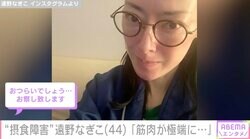 摂食障害を公表・遠野なぎこ「筋肉が極端に無くなっているから」ソファに座る際の苦痛を訴える