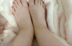  手島優、様子がおかしい浮腫み過ぎて痛む足「土踏まずもどこいった？」 