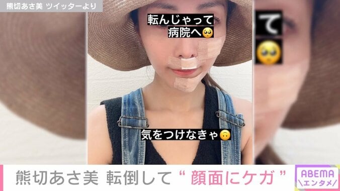 熊切あさ美、転倒して“顔面にケガ”「1、2週間で良くなるはず」「昔から転ぶのが下手で」 2枚目