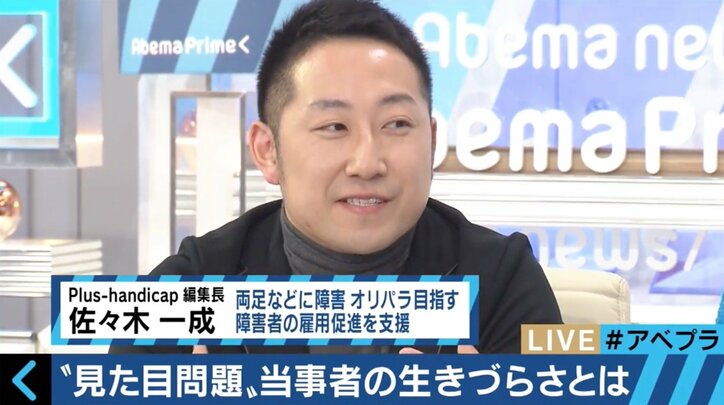 実は100万人が抱える“見た目問題” 当事者たちの生きづらさとは