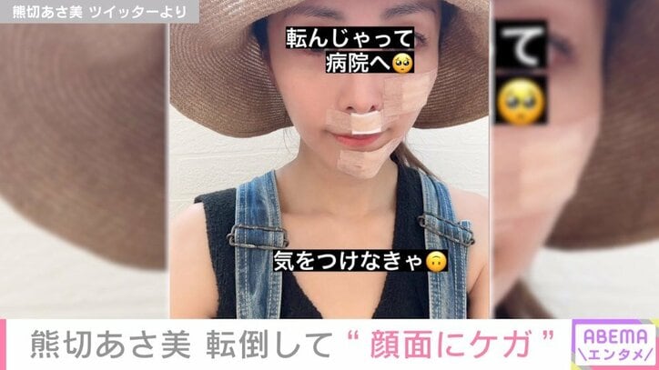 熊切あさ美、転倒して“顔面にケガ”「1、2週間で良くなるはず」「昔から転ぶのが下手で」
