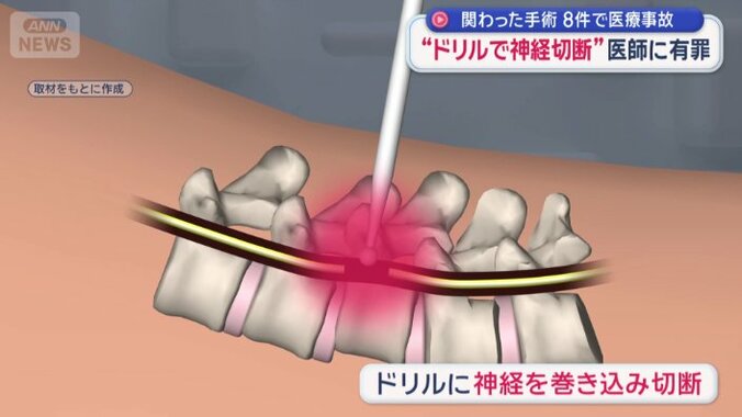 「スチールバー」と呼ばれるドリルで…