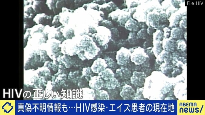 HIVウイルス