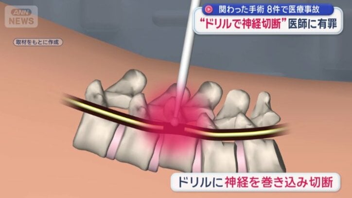 「スチールバー」と呼ばれるドリルで…