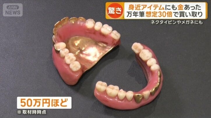 50万円ほどになる入れ歯も