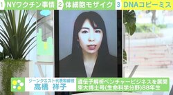 「30人に1人」感染症予防の糸口に？ コロナ重症化のリスク高める“体細胞モザイク”今後の可能性