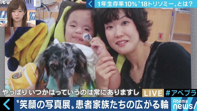 “1年以上の生存率は10％”…18トリソミー児の家族たちが写真展に託した苦悩と葛藤 12枚目
