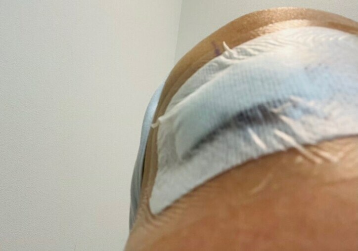  薬丸裕英、数年悩んでいた症状で手術を受けたことを報告「皮膚がふくらむ疾患」 