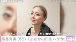 ビキニ姿が話題・熊谷真実（65）、「まさかの円形ハゲが」写真を公開し心配の声「体大事にしてよ」