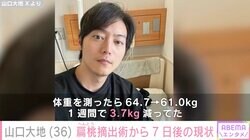 『仮面ライダーゼロワン』『東リベ』出演の山口大地、扁桃摘出術から7日後の現状報告「未だ水を飲むのも激痛」