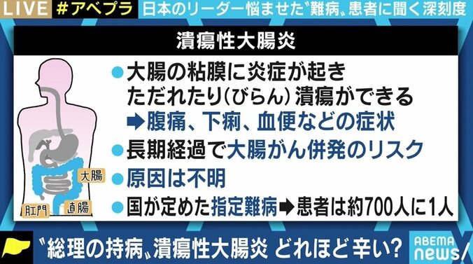 「ひどい時はトイレに1日20回以上｣ “総理の持病”潰瘍性大腸炎 難病との闘いを当事者に聞く 3枚目