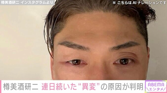 「体が悲鳴を…」樽美酒研二（44）、連日続いた“異変” まさかの原因が判明「全く気にもしてませんでした」 4枚目