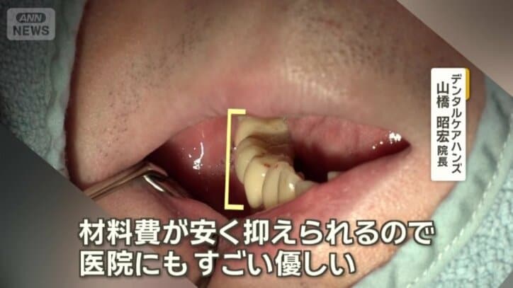 歯科医院としてもメリットが