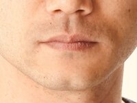 小泉貴之『致命的な悩み！』