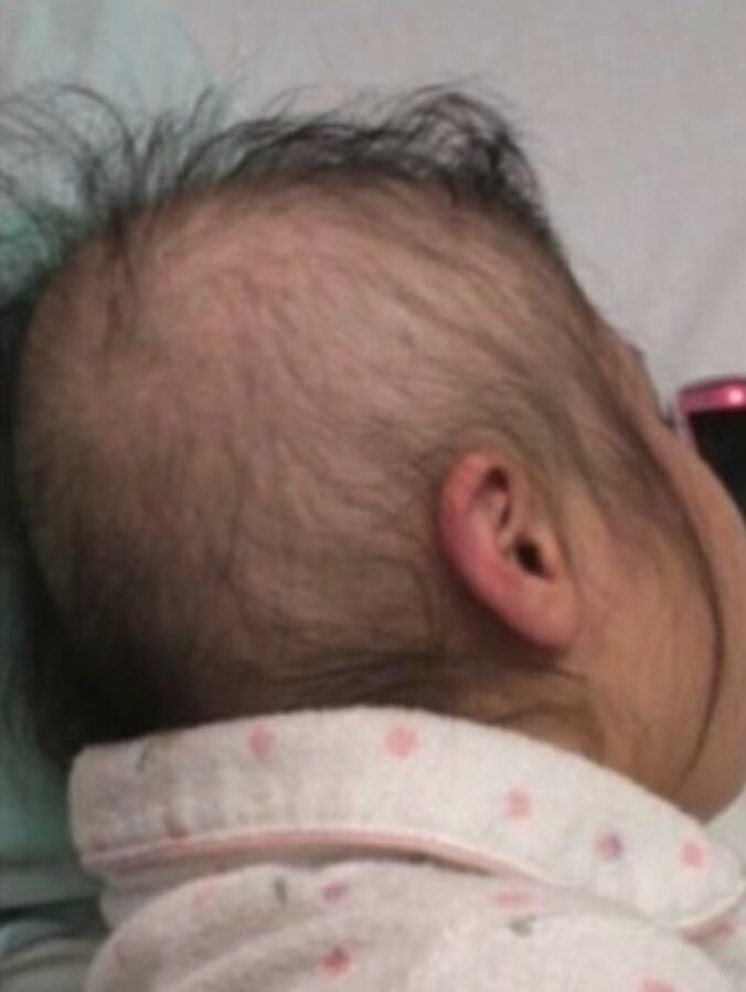  女優・友寄蓮、抗がん剤治療による脱毛事情「映画では描かれない脱毛のリアル」  1枚目