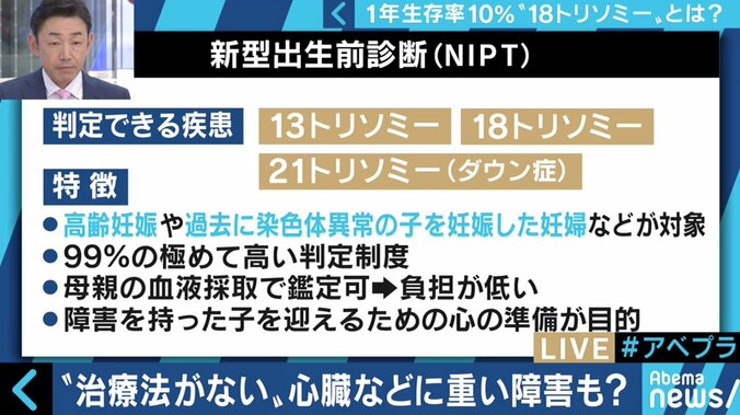 “1年以上の生存率は10％”…18トリソミー児の家族たちが写真展に託した苦悩と葛藤 3枚目