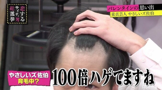「思ったより100倍ハゲてる」指原莉乃、やさしいズ・佐伯のM字ハゲに驚愕 4枚目