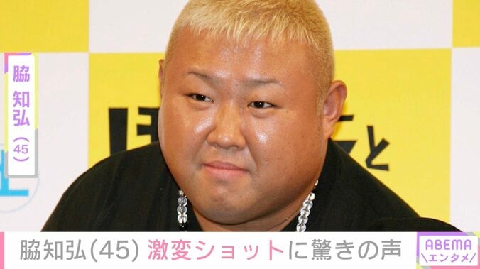 【写真・画像】『ごくせん』俳優・脇知弘（45）、10kg減量した姿に驚きの声「ど、どうやって!?」「ムキムキになってきてますね」　1枚目