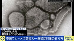 中国で急拡大「ヒトメタニューモウイルス」とは？専門家「珍しくないありふれたウイルス」平時に考える感染症対策