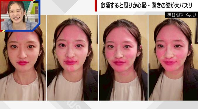 飲酒で顔がまだらに赤く変色