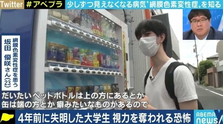 少しずつ奪われる視力、視野…“見えることが前提の社会”で悩む5万人の網膜色素変性症患者たち