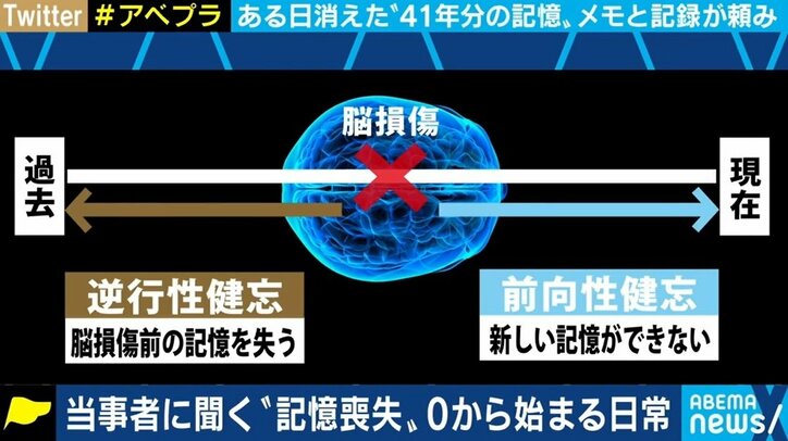 毎朝自分の名前を確認、初対面状態の母親に挨拶 “41年”を失った当事者に聞く「記憶喪失」