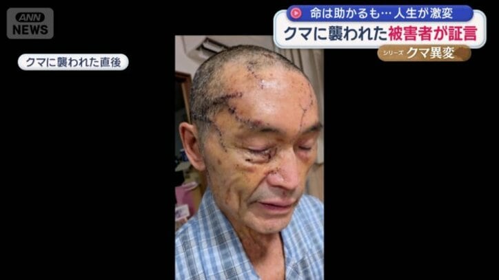 頭部を中心に大けがをした男性