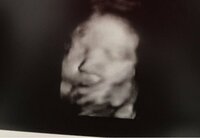 後藤真希『妊娠検診』