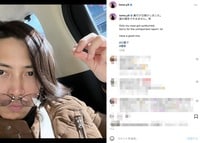 山下智久、日焼けした鼻先を公開 お茶目な報告に「ワイルドなのに…かわいい」「日焼けしてもイケメン」歓喜の声